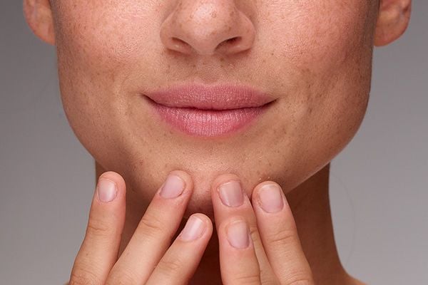 What is alipic skin? How to differentiate it from dry skin? • Saper
